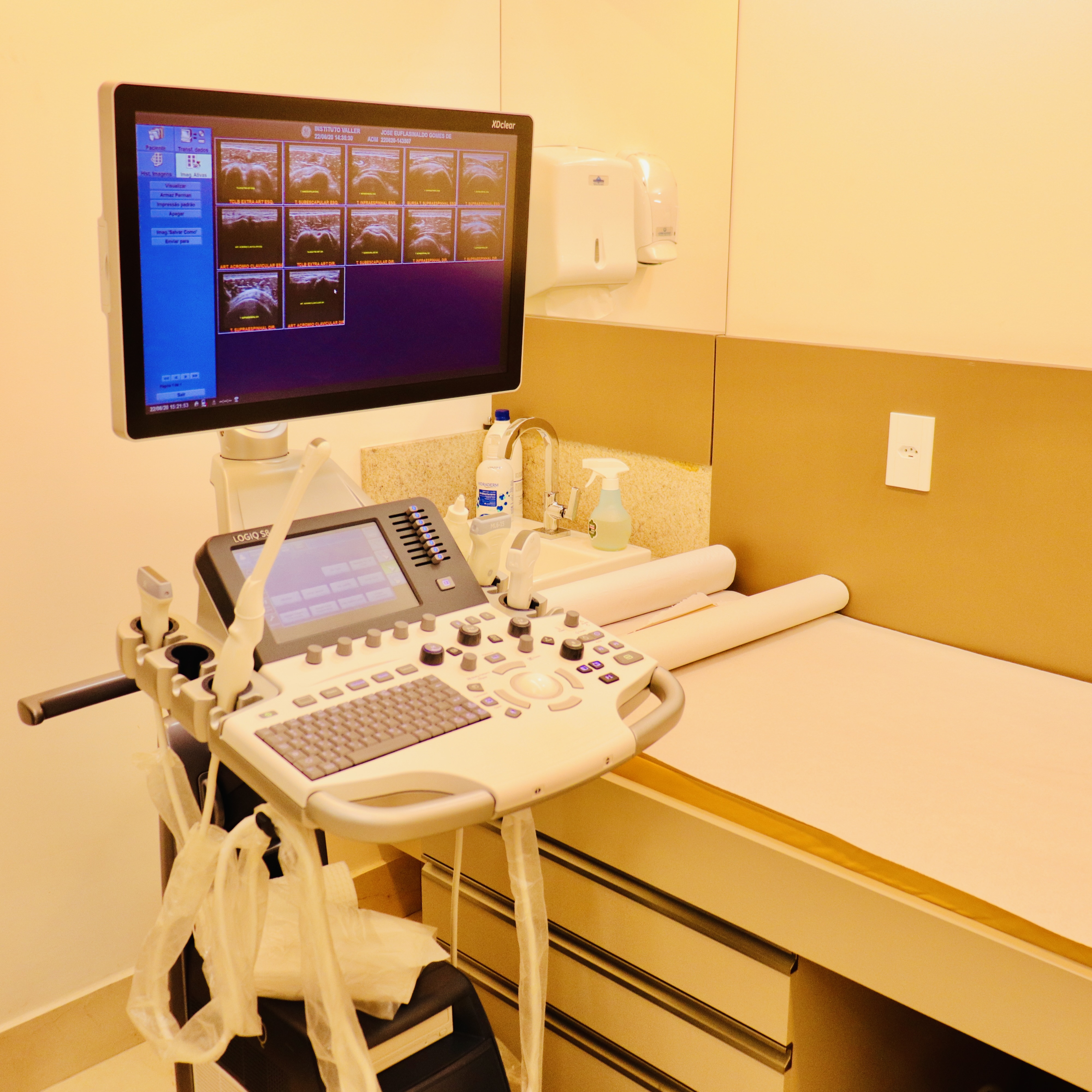 Equipamento de ultrassonografia do Instituto Valler em detalhe.